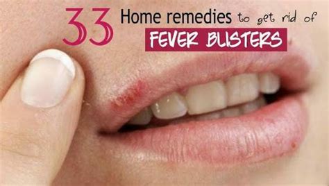 Sign in | Fever blister, How to heal blisters, Sore lips