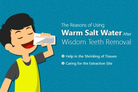 Wisdom Teeth Salt Water Rinse – Boston Dentist – Congress Dental Group 160 Federal St Floor 1 ...