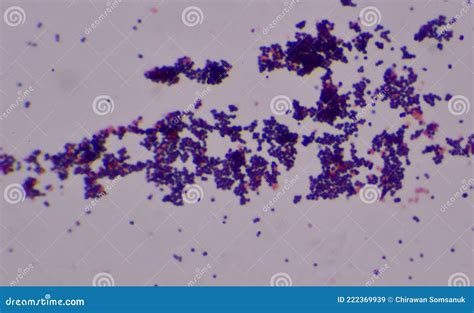 Gram Positive Cocci Finding with Microscope Stock Image - Image of ...