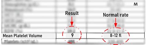 MPV (Mean Platelet Volume) : Blood Test, Value, Results and Interpretation