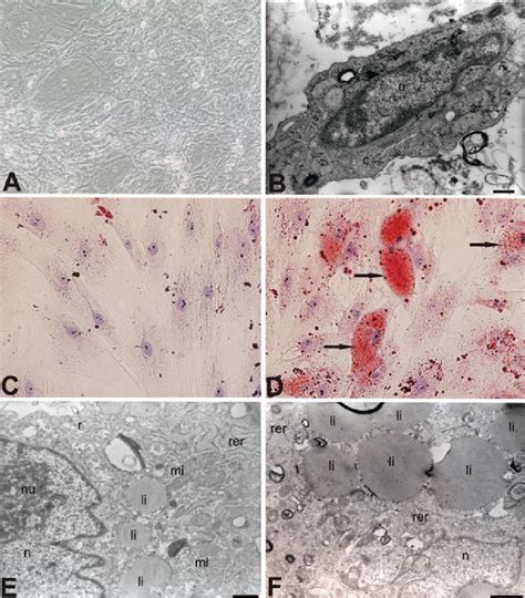 a Morphology of adherent cells in primary culture of UCB-MSCs. b TEM of ...