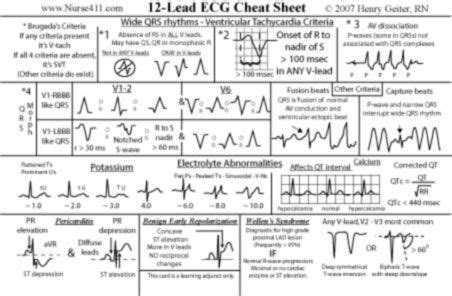 Pin on Ekg interpretation cheat sheets