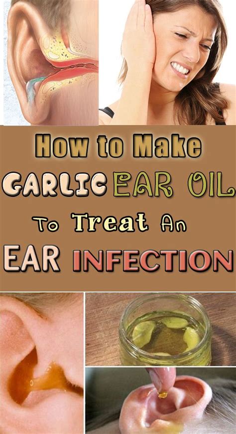 How to Make Garlic Ear Oil to Treat an Ear Infection - First Home Remedy | Ear infection home ...