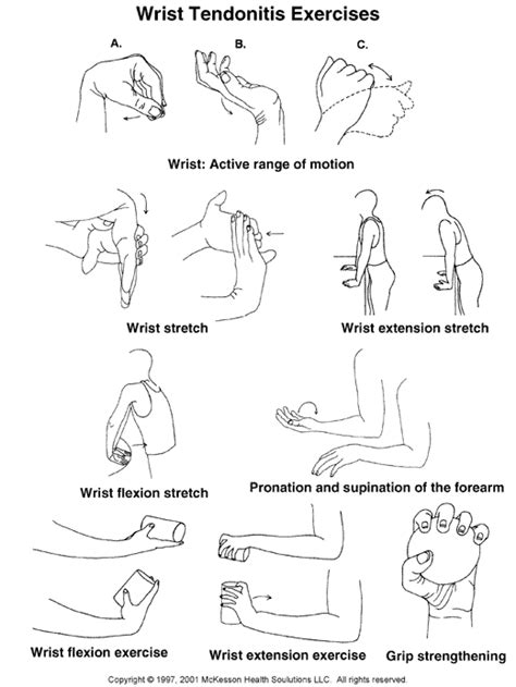 Sports Medicine Advisor 2003.1: Wrist Tendonitis Exercises: Illustration