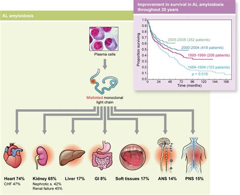 Back in July/Emergency Stem Cell Transplant | csinvesting