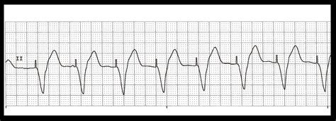 EKG Rhythm Quiz 250