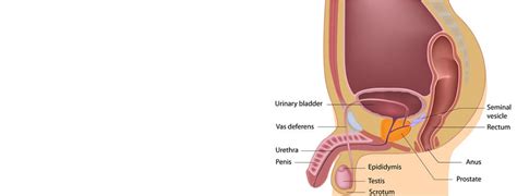 Bladder Neck Incision - East West Urology Adelaide