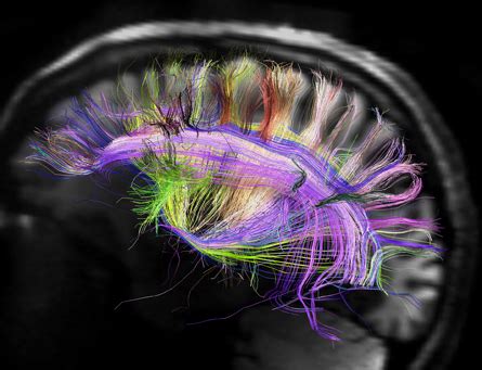 bensozia: Neural Pathways are not so Messy