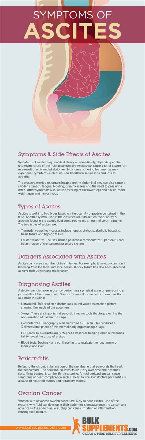 Ascites: Symptoms, Causes & Treatment