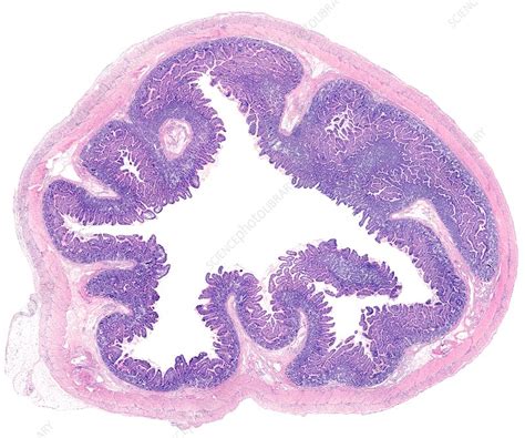 Ileum : Endoscopy Terminal Ileum Normal Finding Doccheck / The ileum measures about 11.5 feet ...