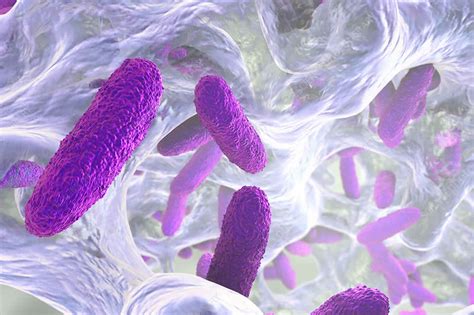 Klebsiella pneumoniae infection causes, symptoms, diagnosis, treatment ...