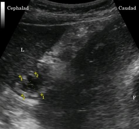 Ultrasonographic image of the gastric antrum The figure demonstrates... | Download Scientific ...