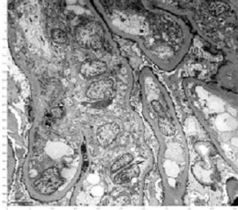 Electron microscope, magnification × 40000 (scale bar: 1 μ m ...