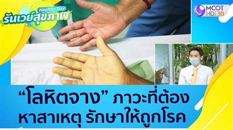 (คลิปเต็ม) "โลหิตจาง" ภาวะที่ต้องหาสาเหตุ รักษาให้ถูกโรค : Healthy Day ...