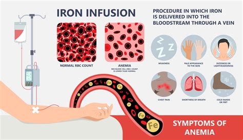 The Cottage Surgery Ferinject Iron Infusion administration - The Cottage Surgery