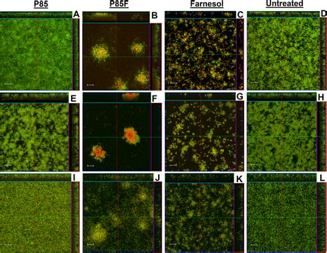 Morphology of S. mutans biofilms grown with Pluronics-formulated ...