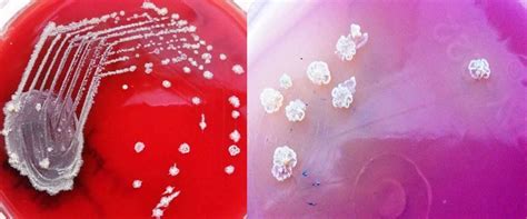 A-Colony morphology of P.stutzeri in blood agar showing2-3 mm, grey to ...