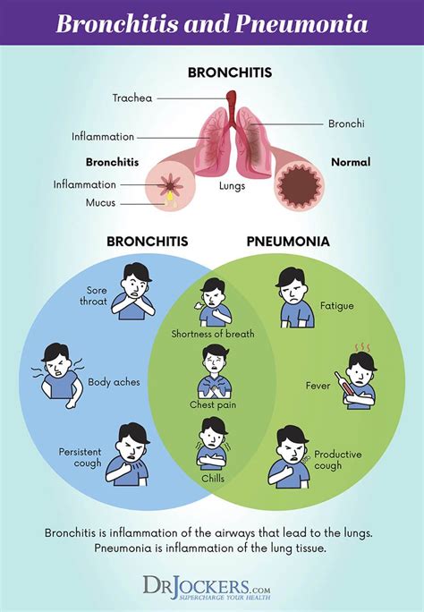 Bronchial Pneumonia