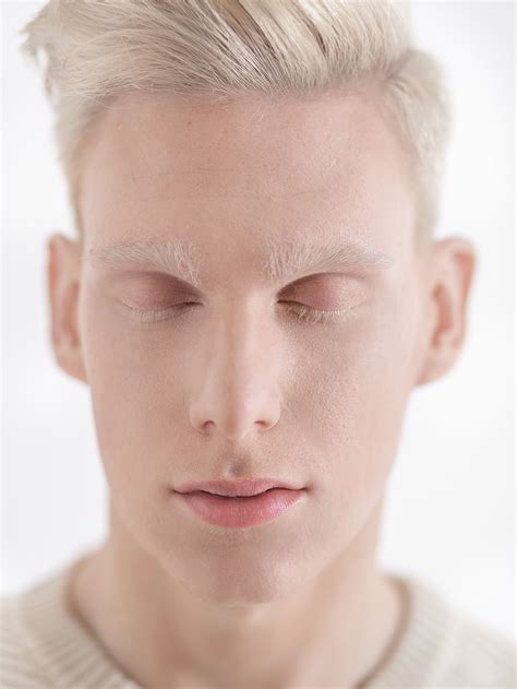 Albino model by Valeria Lokinskaya | Albino, Albino model, Albino men