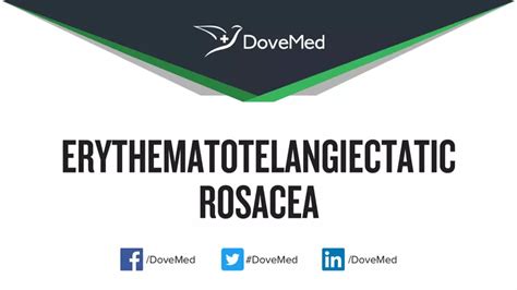 Erythematotelangiectatic Rosacea - DoveMed