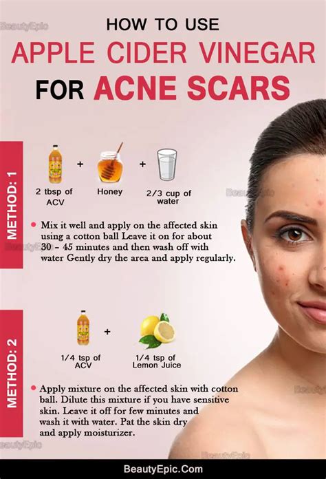 How To Get Rid of Acne Scars Quickly with Apple Cider Vinegar