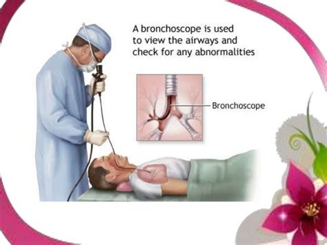 Biopsies in lung cancer diagnosis process