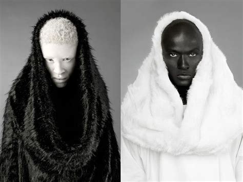 Shaun ross, Melanism, Human