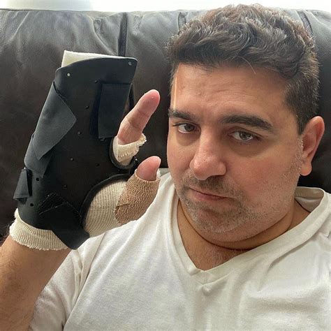 Buddy Valastro Gives Update After Third Hand Surgery: 'Rough Road to ...