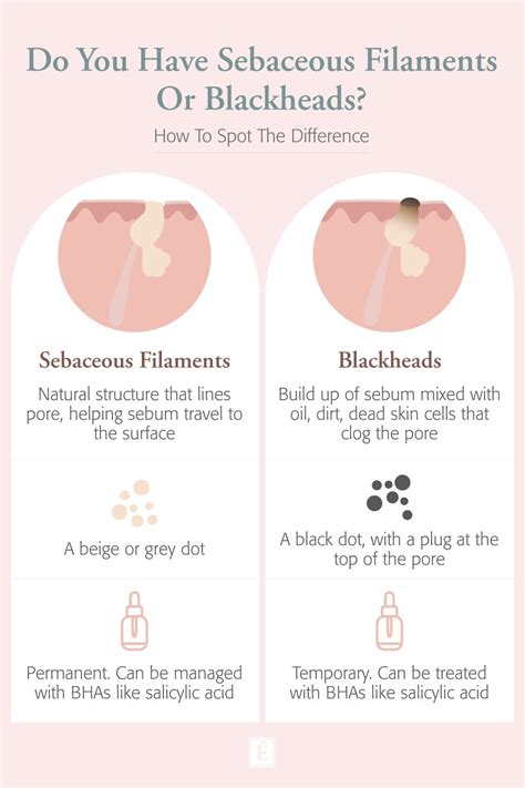 Sebaceous Filaments Vs. Blackheads - What’s The Difference? | Sebaceous ...