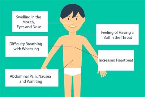 Anaphylactic shock- what is this and how can it be treated?