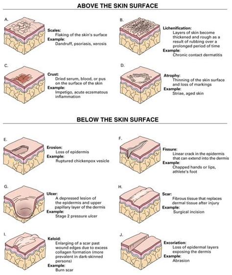 Skin Lesions Causes