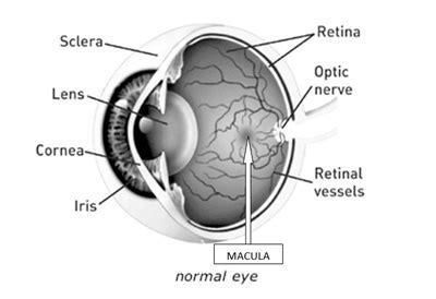 RetinaCare | Guide to Epiretinal Membranes