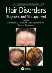 Hair Disorders: Diagnosis and Management - 1st Edition - Alexander C.