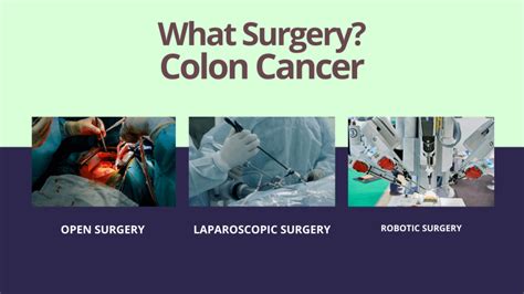 Surgery for colon cancer: Best option for you