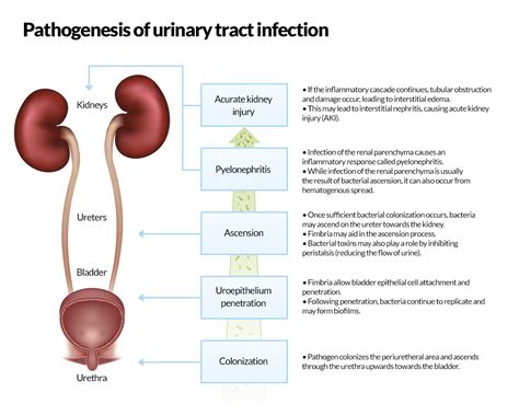 Urinary Tract Infection, Infections, Nursing Ceu, Continuing Education ...