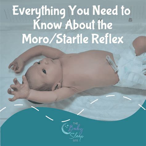 The Moro Reflex (or Startle Reflex) | Newborn Sleep Patterns