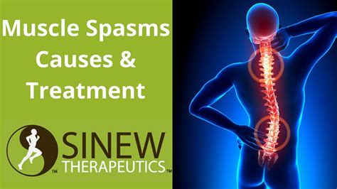 Muscle Spasms Causes and Treatment - YouTube