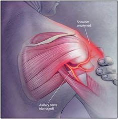 36 Rotator Cuff Exercises ideas | rotator cuff, rotator cuff exercises ...