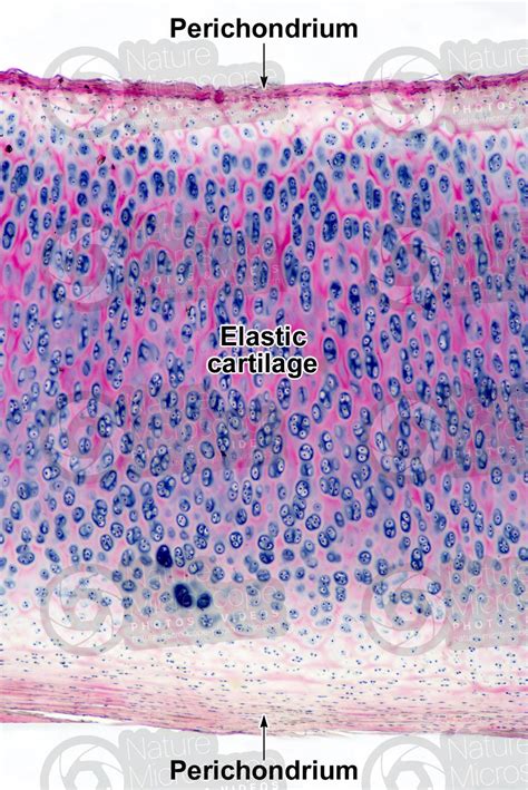 Mammal. Elastic cartilage. Transverse section. 64X - Elastic cartilage ...