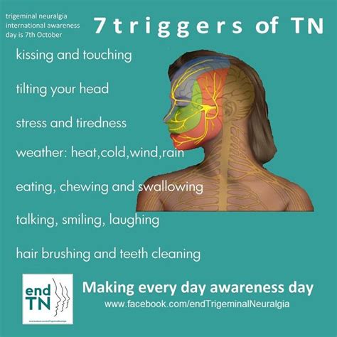 138 best images about Trigeminal Neuralgia And TMJ on Pinterest ...