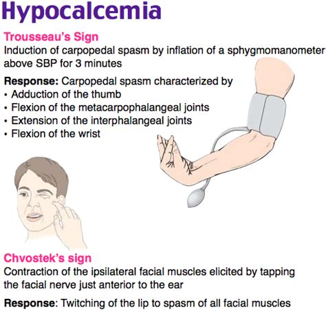 Signos de Hipocalcemia: trousseau y chvostek | Endocrine system nursing ...