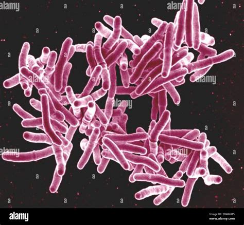 Mycobacterium tuberculosis Bacteria, the Cause of TB Scanning electron ...