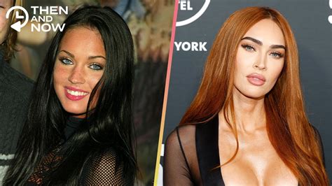 Celebrities Before And After Plastic Surgery - YouTube