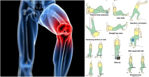 6 Knee Strengthening Exercises For A Meniscus Tear - GymGuider.com zawsa