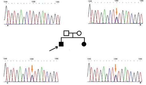 The point mutation verified by Sanger sequencing. (a) was the ...