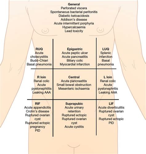 Acute abdominal pain and starting DDX by quadrant | Doctor Stuff | Pinterest | Shorts, Pain d ...