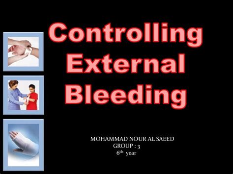 Controlling External Bleeding