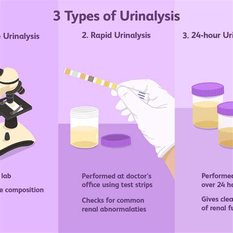 Urinalysis: What Is It, Testing, Indications, And More, 46% OFF