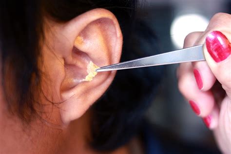Ear Wax Removal in Tucson | Tucson Audiologist | Sonora Hearing Care, LLC