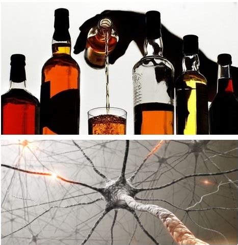 Does Alcohol Kill Brain Cells? | New Health Advisor